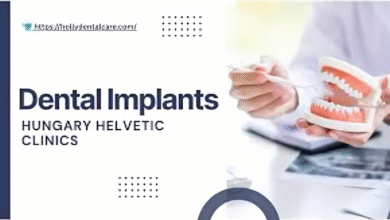 Dental Implants Hungary Helvetic Clinic